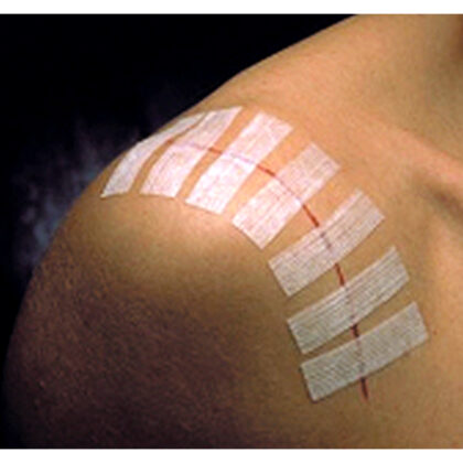 3M Steri-Strip hechtstrips