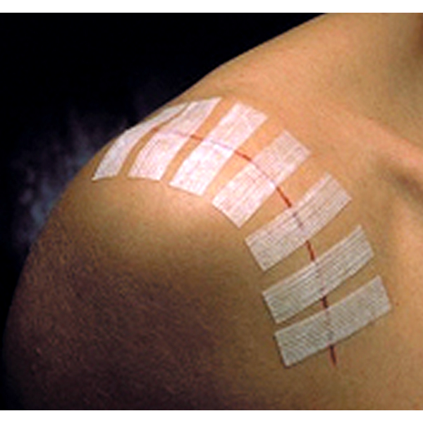 3M Steri-Strip hechtstrips